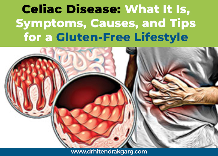 Celiac Disease: What It Is, Symptoms, Causes, and Tips for a Gluten-Free Lifestyle
