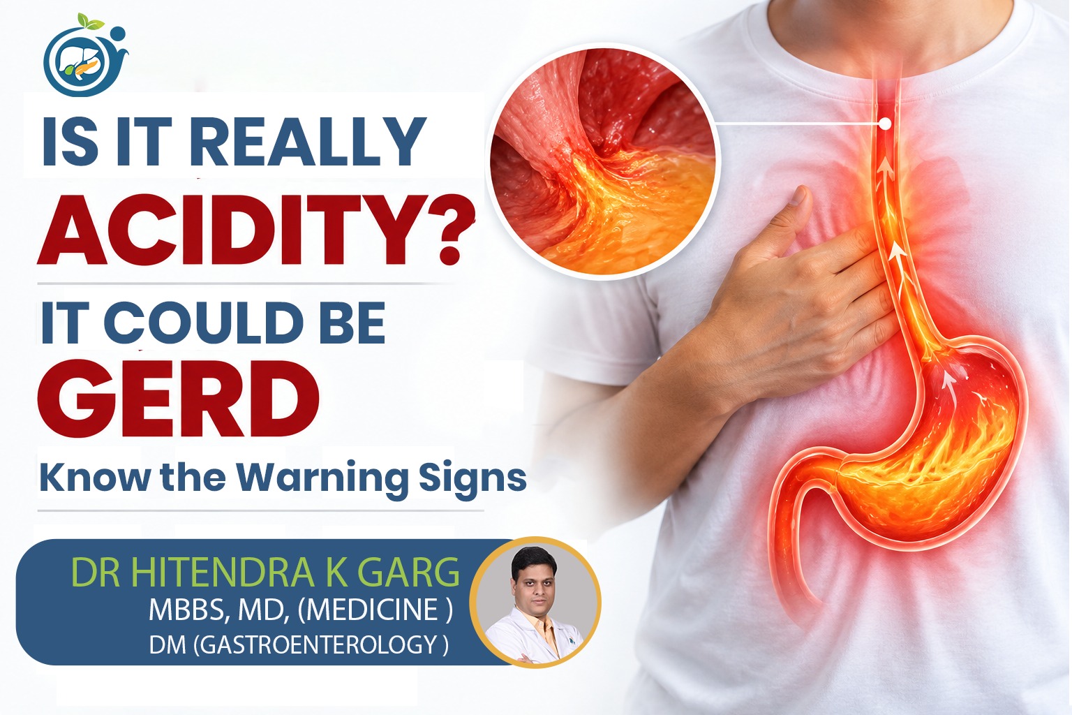 Is Your Acidity Actually GERD? Know the Difference Before It's Too Late