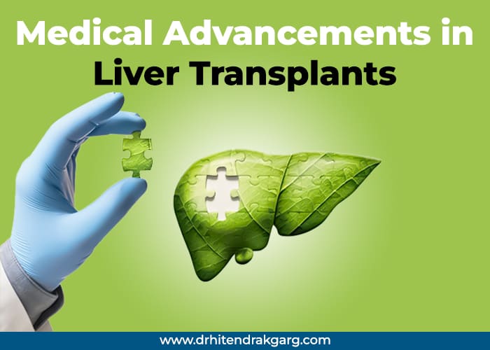 Medical Advancements in Liver Transplants