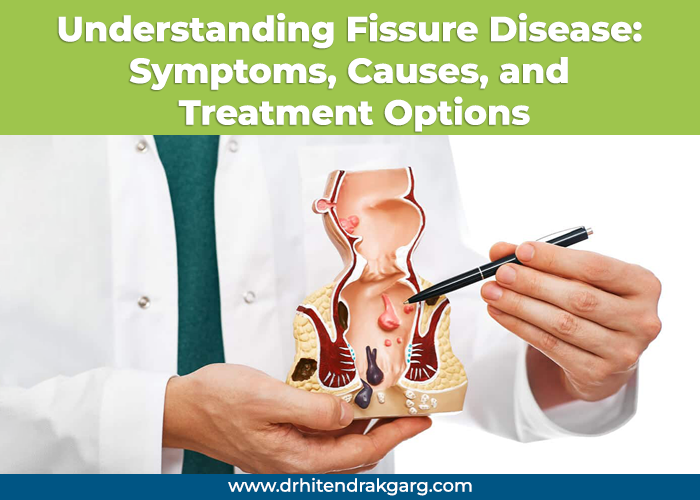 Understanding Fissure Disease: Symptoms, Causes, and Treatment Options